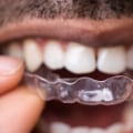 Can Clear Aligners Damage Teeth?