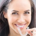 Can Clear Aligners Fix Gaps? A Comprehensive Guide