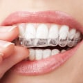 Are Clear Aligners Safe? An Expert's Perspective