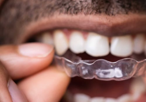 Can Clear Aligners Damage Teeth?