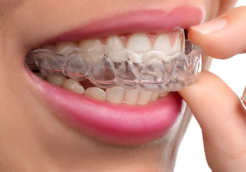 Can Clear Aligners Cause Gum Recession?