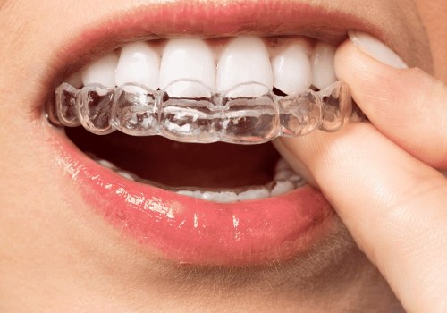 Are clear aligners fda approved?