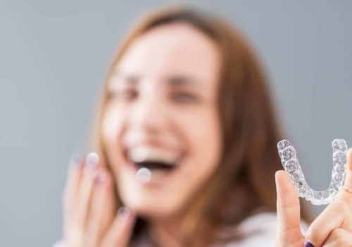 Where to Find Clear Aligners for a Perfect Smile