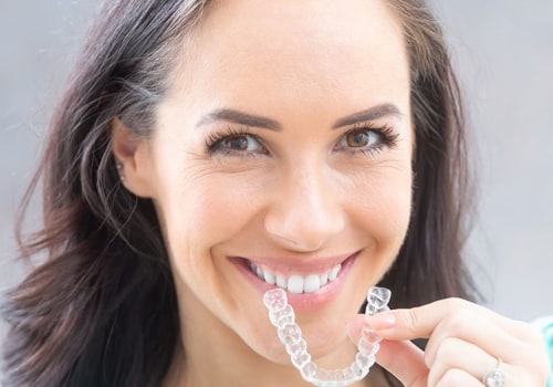 Can Clear Aligners Close Gaps? A Comprehensive Guide